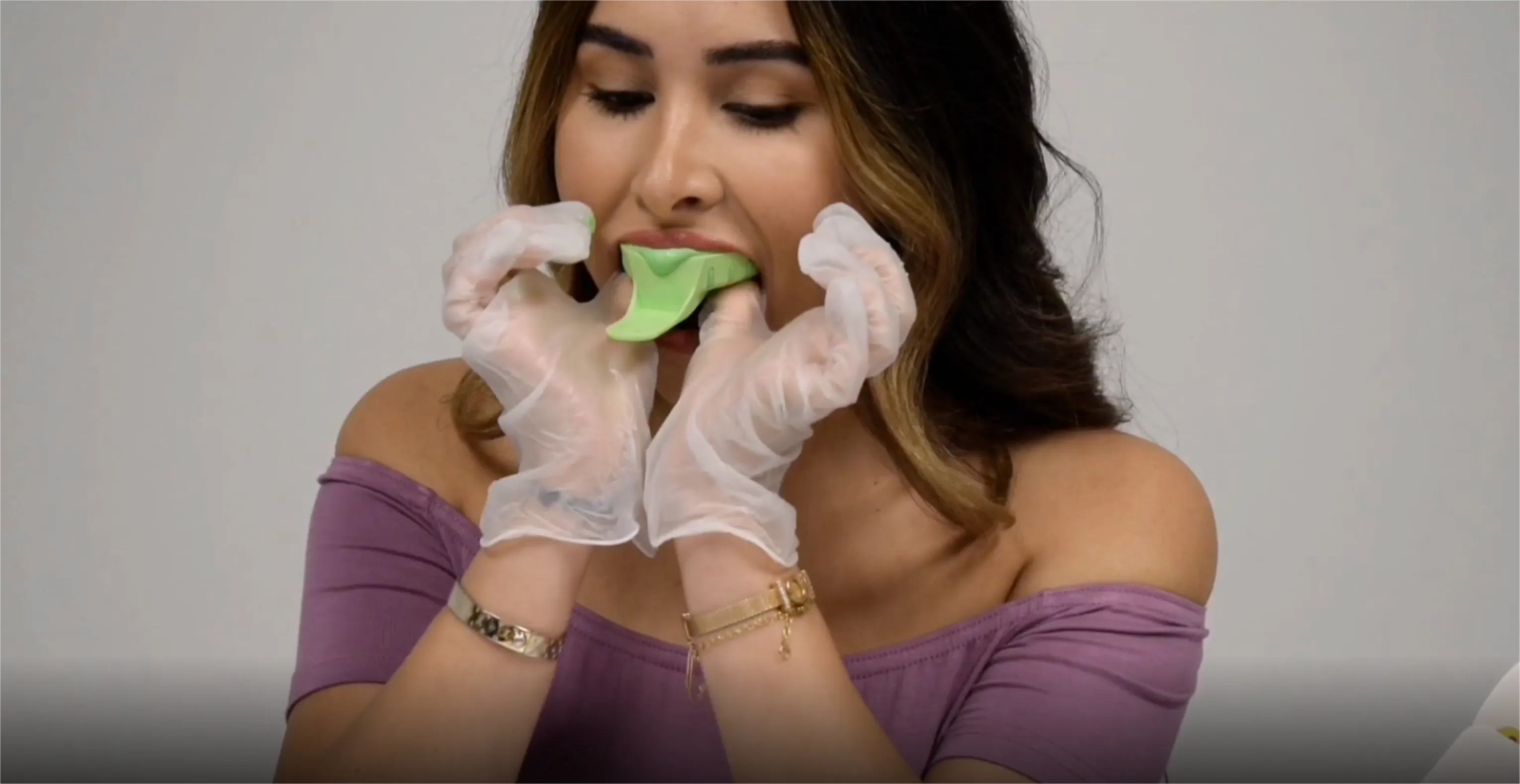 Impression Kit - Retainers